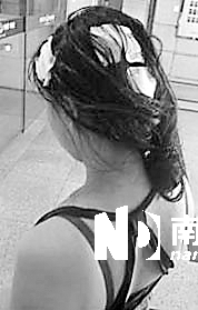 <p>    傷者頭部被砸出多個(gè)血洞。 通訊員杜亞軍南都記者徐文閣 攝</p>