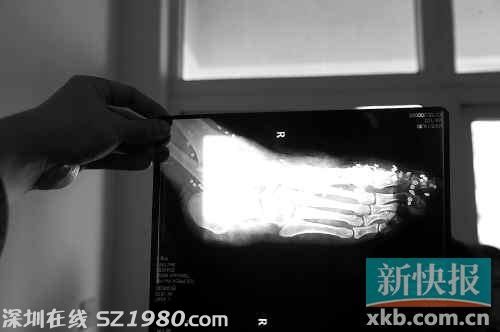 男子廣州賭博輸800元 持霰彈槍將贏家打傷
