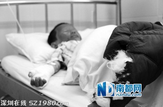 東莞三孩童撿來個氫氣球 忽然爆炸二級燒傷