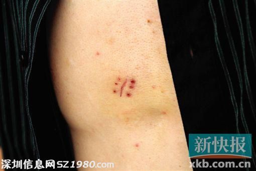 廣州司機(jī)開著車窗 突見尖刀伸進(jìn)來架脖搶劫