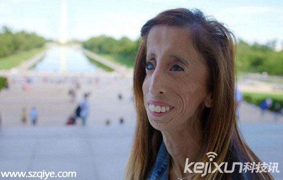 世界上最丑女人幼年飽受凌辱 網友曾評為何不燒死