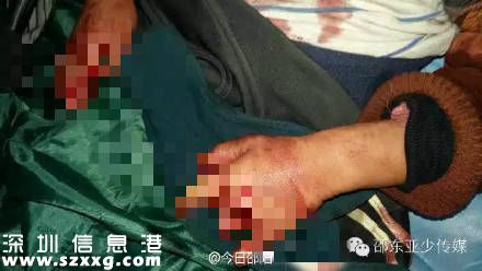 湖南6歲男童被砍十多刀 重要部位被砍斷