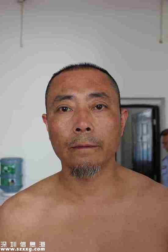 2013年4月22日，王志剛被轉送到劍閣縣看守所，重新檢查了身體狀況。照片顯示，王志剛的后背有條狀色素沉著。