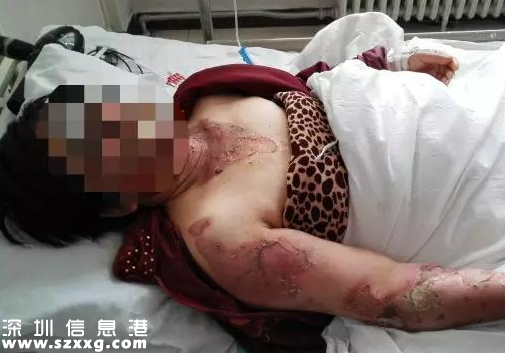 兒媳開(kāi)水潑婆婆 專家支招解決婆媳關(guān)系