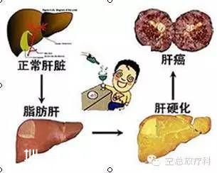 港大深圳(www.thesurfingworld.com)醫(yī)院開設(shè)肝癌門診 多位資深專家坐診