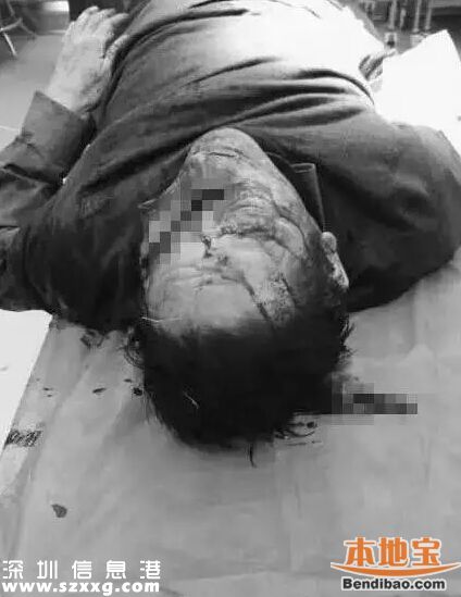安徽醫(yī)生被砍死 事發(fā)時(shí)醫(yī)生正在睡覺