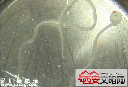 吉安籍男童腦里長(zhǎng)寄生蟲(chóng) 發(fā)現(xiàn)面部及右側(cè)肢體抽搐后送醫(yī)治療