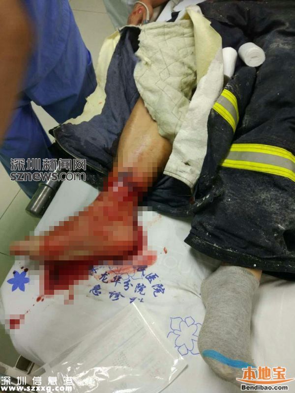 龍華電子廠火災(zāi)續(xù) 受傷消防員左眼取出碎片