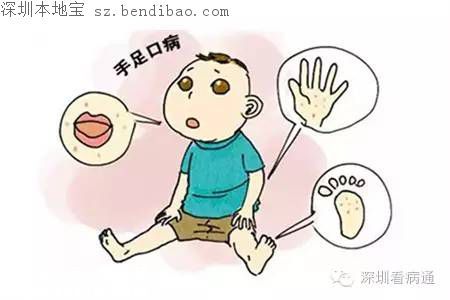深圳手足口病疫苗來了！寶安鹽田南山開始供應(yīng)