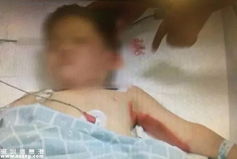 深圳司機(jī)碾壓3兒童續(xù)：未酒駕 正調(diào)查是否看手機(jī)