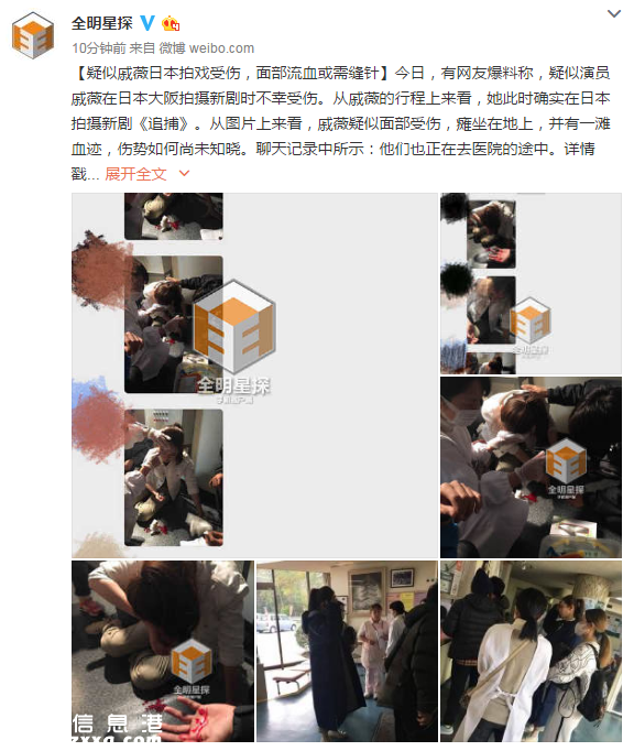 戚薇日本拍戲受傷畫(huà)面 竟自嘲人在江湖飄哪有不挨刀