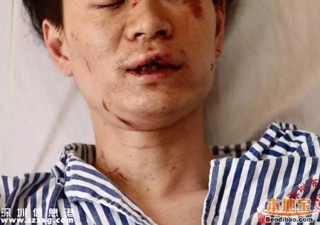 深圳百萬跑車撞成廢鐵 司機回家睡覺
